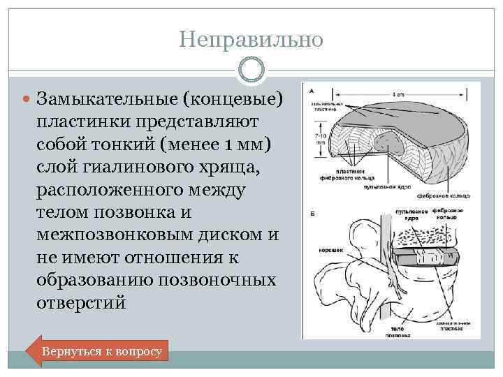 Склероз замыкательных пластинок. Замыкательная платина. Замыкательная пластинка. Замыкательные пластины. Замыкательные пластины позвонков.