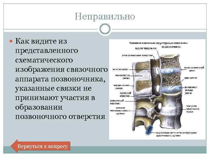 Повреждение капсульно связочного аппарата