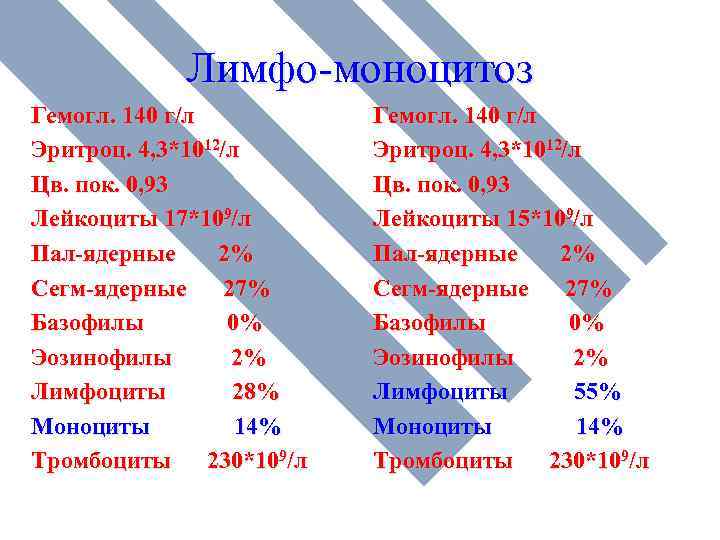 Лимфо-моноцитоз Гемогл. 140 г/л Эритроц. 4, 3*1012/л Цв. пок. 0, 93 Лейкоциты 17*109/л Пал-ядерные