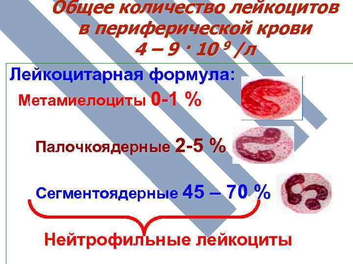 Общее количество лейкоцитов в периферической крови 4 – 9 · 10 9 /л Лейкоцитарная