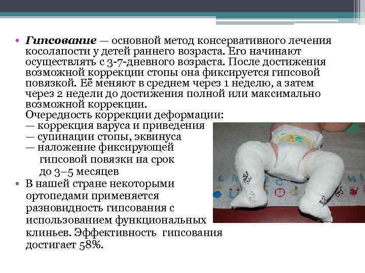  • Гипсование — основной метод консервативного лечения косолапости у детей раннего возраста. Его