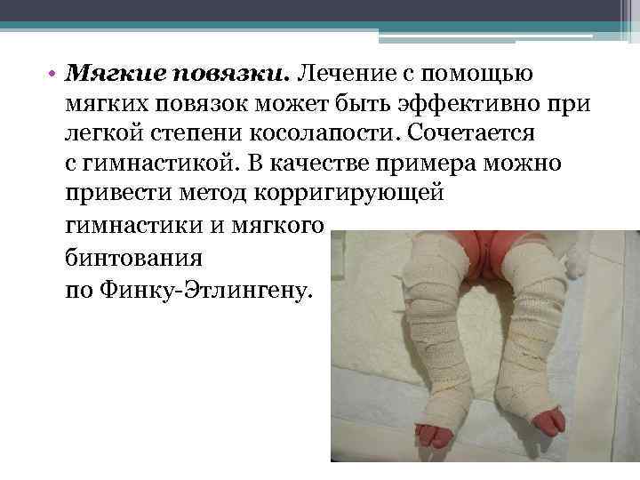  • Мягкие повязки. Лечение с помощью мягких повязок может быть эффективно при легкой
