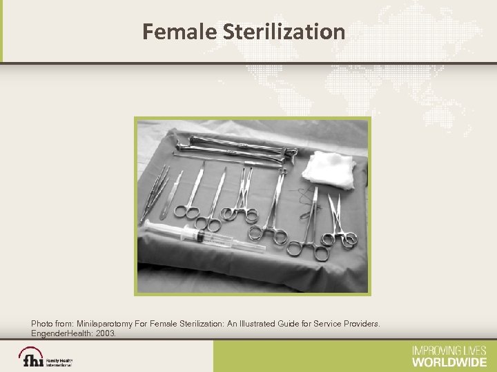 Female Sterilization Photo from: Minilaparotomy For Female Sterilization: An Illustrated Guide for Service Providers.