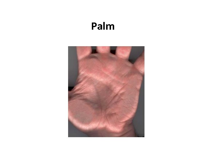 Palm 
