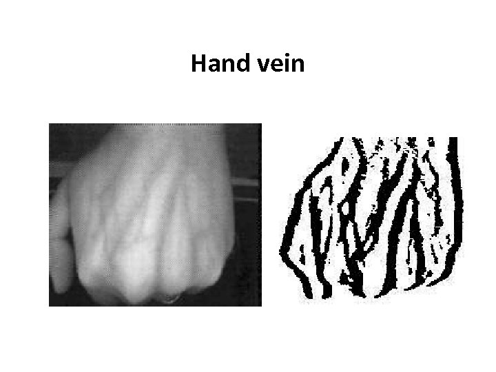 Hand vein 