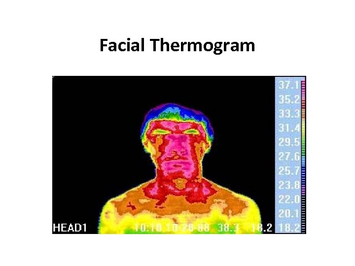 Facial Thermogram 