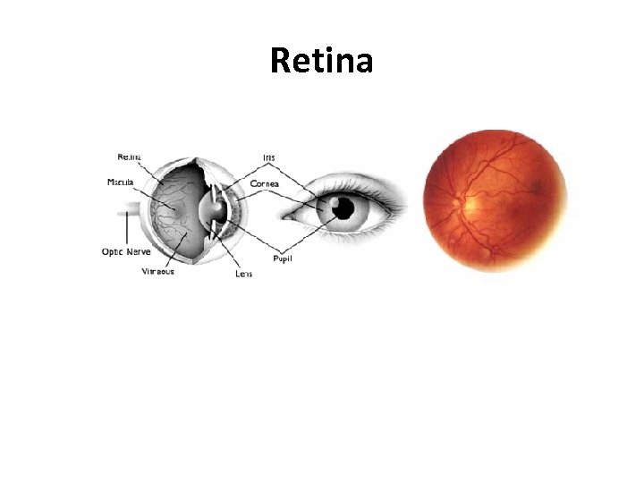 Retina 