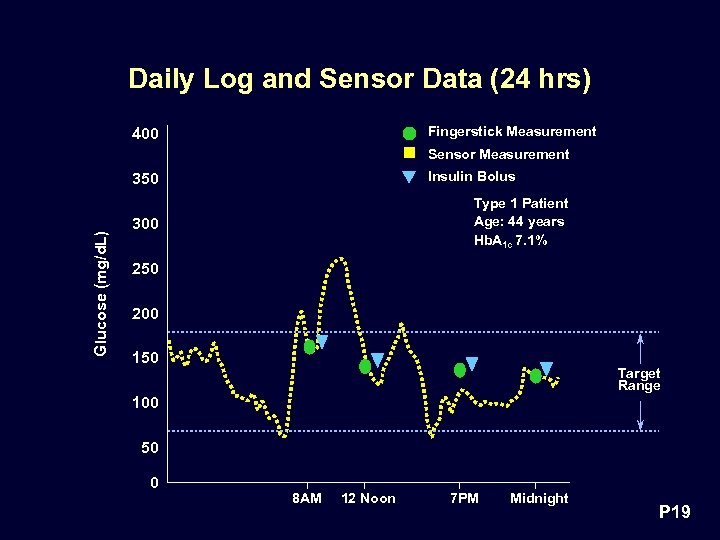Daily Log and Sensor Data (24 hrs) Fingerstick Measurement 400 Sensor Measurement Insulin Bolus