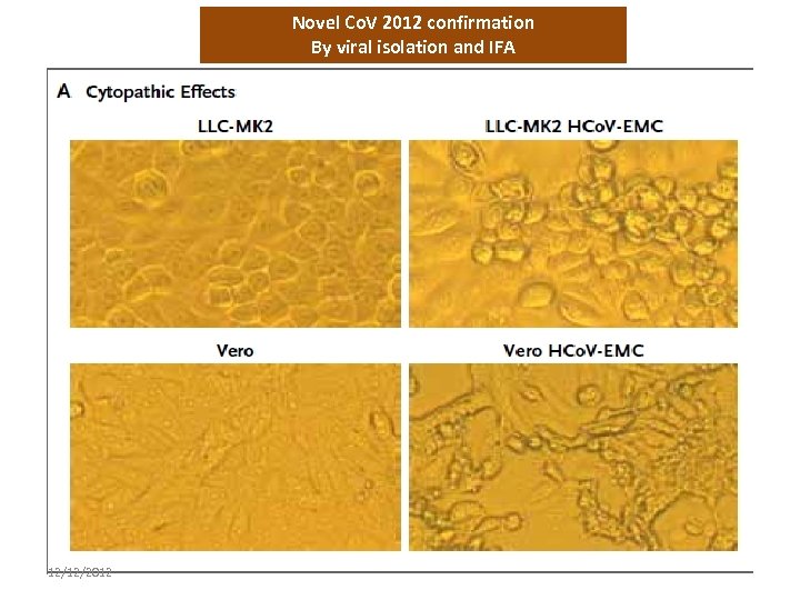 Novel Co. V 2012 confirmation By viral isolation and IFA 12/12/2012 