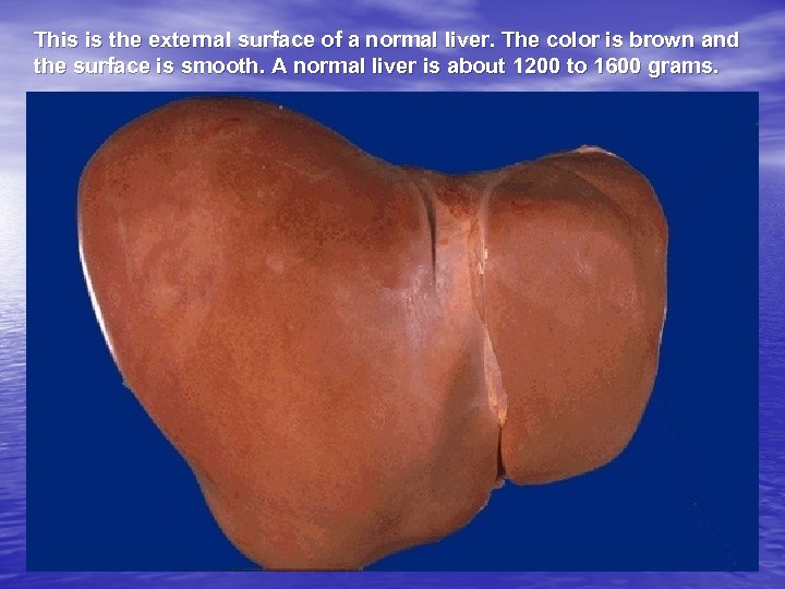 This is the external surface of a normal liver. The color is brown and