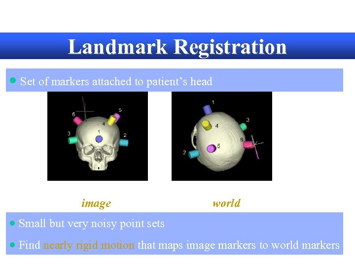 Landmark Registration · Set of markers attached to patient’s head 3 D model image