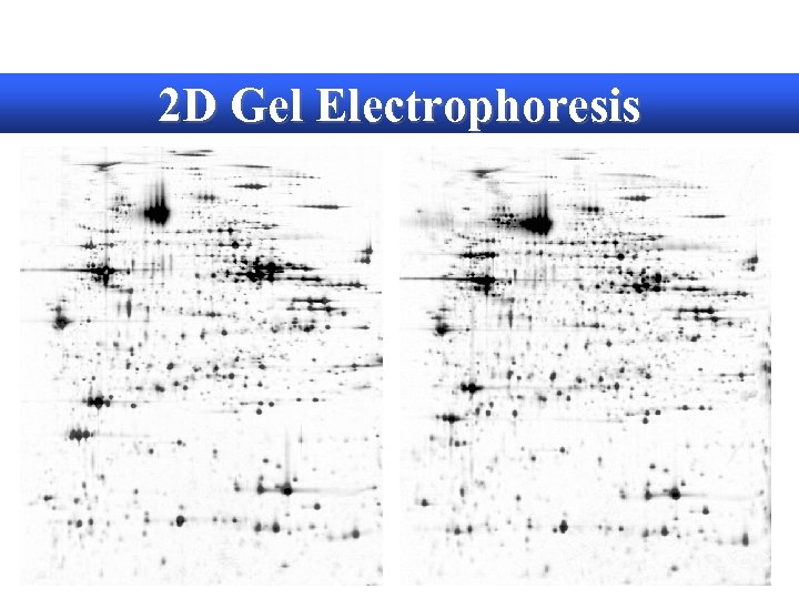 2 D Gel Electrophoresis 