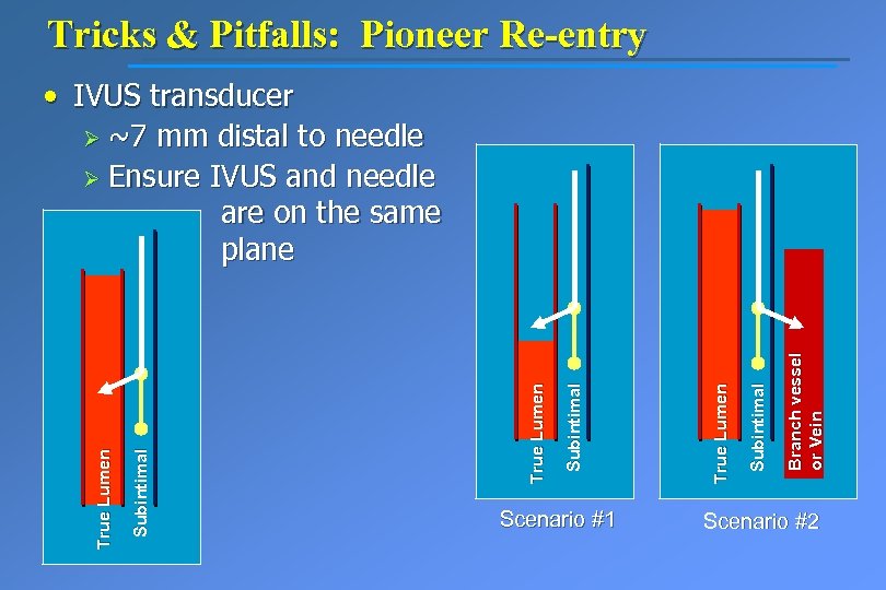 Tricks & Pitfalls: Pioneer Re-entry Scenario #1 Branch vessel or Vein Subintimal True Lumen