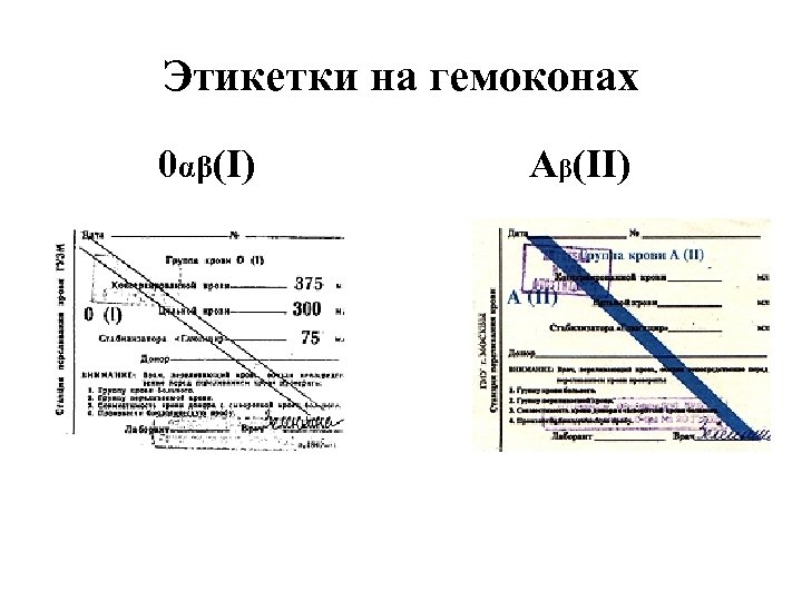 Этикетки на гемоконах 0αβ(I) Аβ(II) 