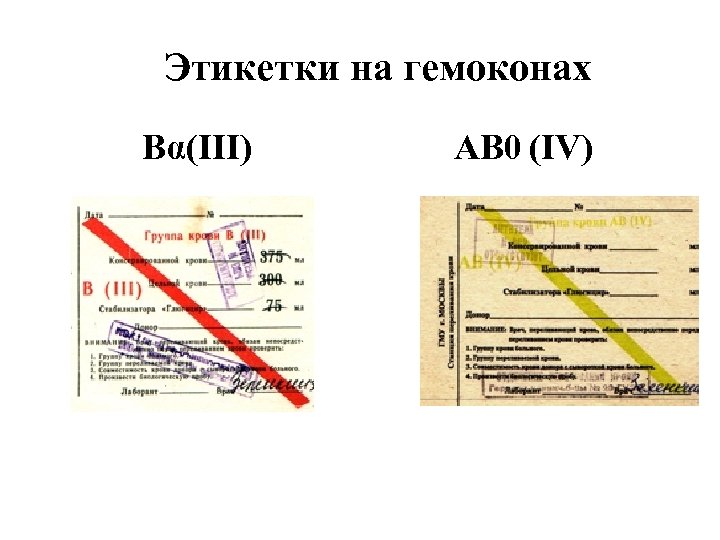 Этикетки на гемоконах Вα(III) АВ 0 (IV) 