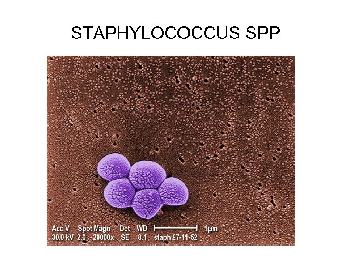 STAPHYLOCOCCUS SPP 