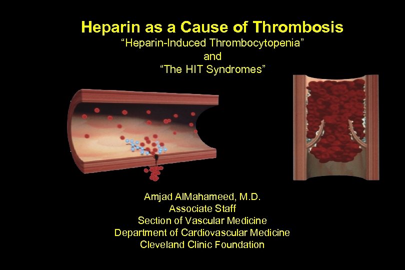 Heparin as a Cause of Thrombosis “Heparin-Induced Thrombocytopenia” and “The HIT Syndromes” Amjad Al.