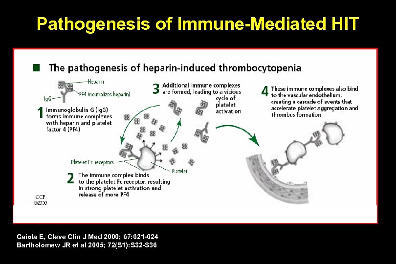 Pathogenesis of Immune-Mediated HIT Caiola E, Cleve Clin J Med 2000; 67: 621 -624