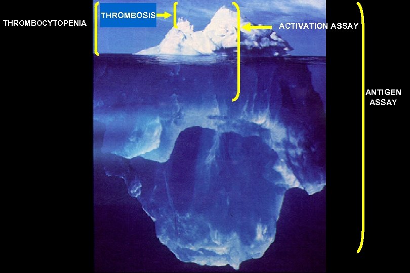 THROMBOCYTOPENIA THROMBOSIS ACTIVATION ASSAY ANTIGEN ASSAY 