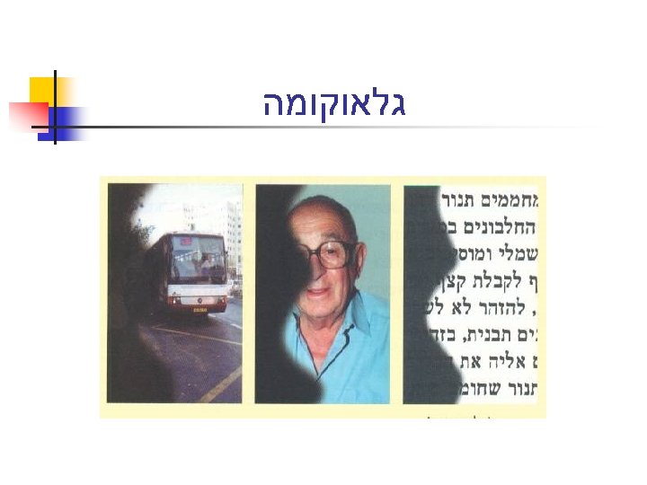  גלאוקומה 
