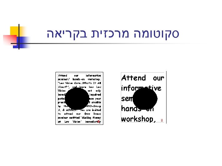  סקוטומה מרכזית בקריאה 