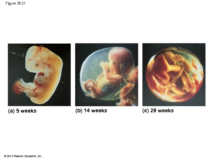 Figure 36. 21 (a) 5 weeks © 2014 Pearson Education, Inc. (b) 14 weeks