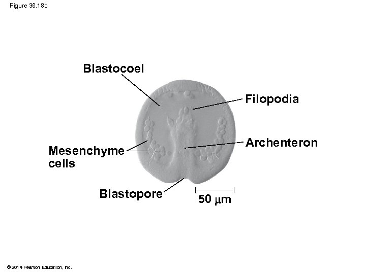 Figure 36. 18 b Blastocoel Filopodia Archenteron Mesenchyme cells Blastopore © 2014 Pearson Education,