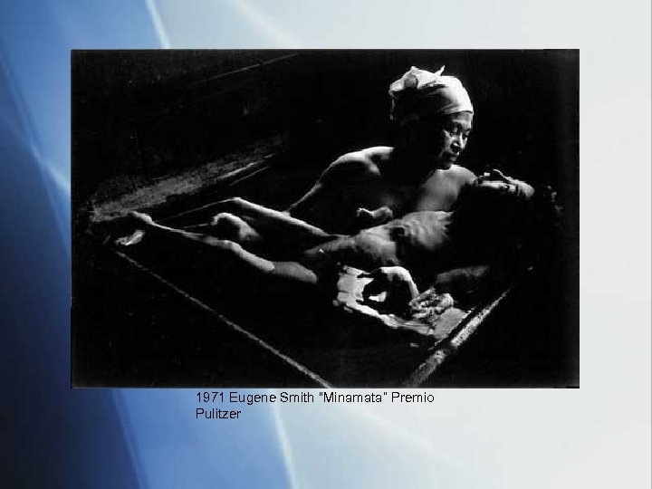 1971 Eugene Smith “Minamata” Premio Pulitzer 