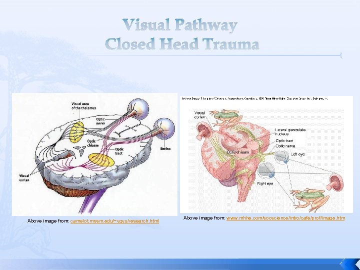 Visual Pathway Closed Head Trauma Above image from: camelot. mssm. edu/~ygyu/research. html Above image
