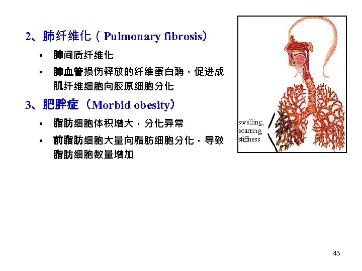 2、肺纤维化（Pulmonary fibrosis） • 肺间质纤维化 • 肺血管损伤释放的纤维蛋白酶，促进成 肌纤维细胞向胶原细胞分化 3、肥胖症（Morbid obesity） • 脂肪细胞体积增大，分化异常 • 前脂肪细胞大量向脂肪细胞分化，导致 脂肪细胞数量增加