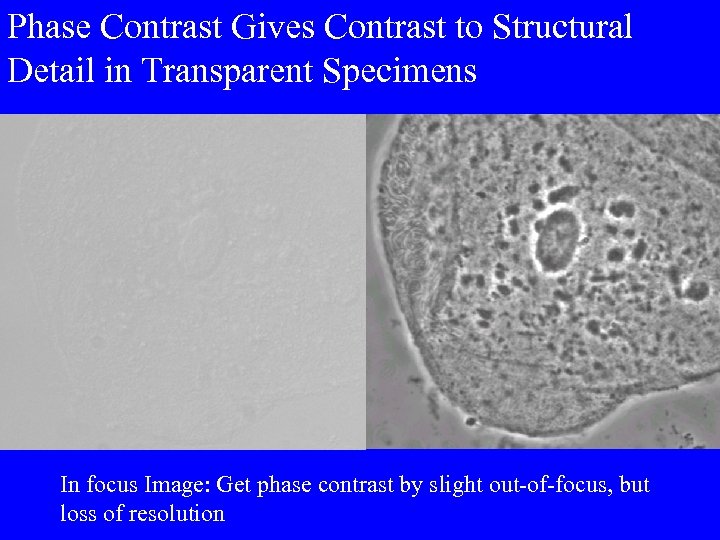Phase Contrast Gives Contrast to Structural Detail in Transparent Specimens In focus Image: Get