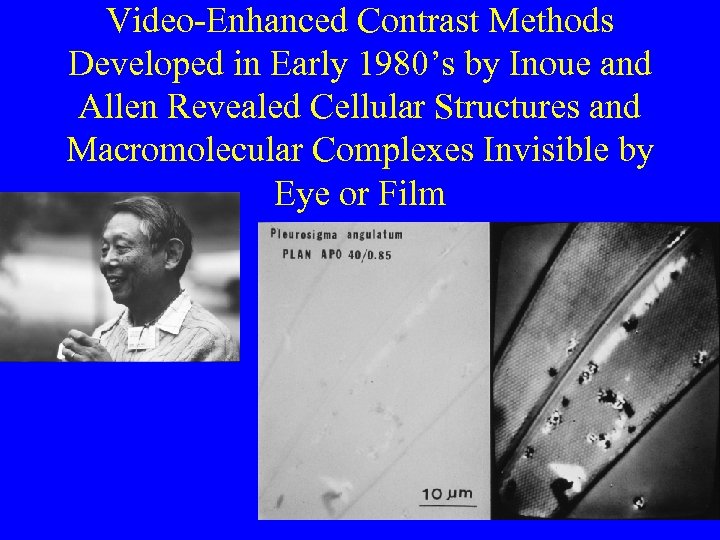 Video-Enhanced Contrast Methods Developed in Early 1980’s by Inoue and Allen Revealed Cellular Structures