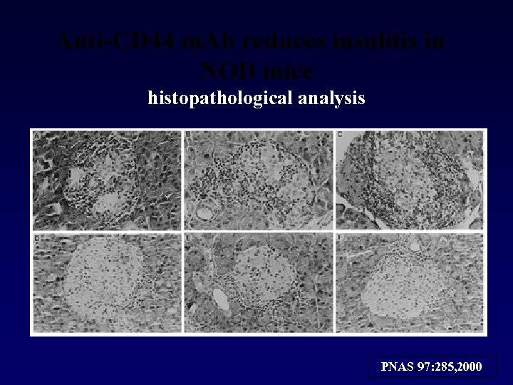 Anti-CD 44 m. Ab reduces insulitis in NOD mice histopathological analysis PNAS, 97: 285,