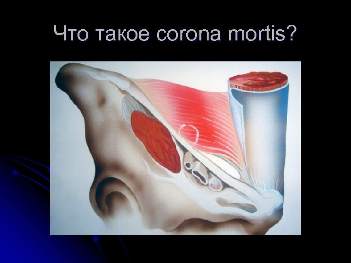 Что такое corona mortis? 