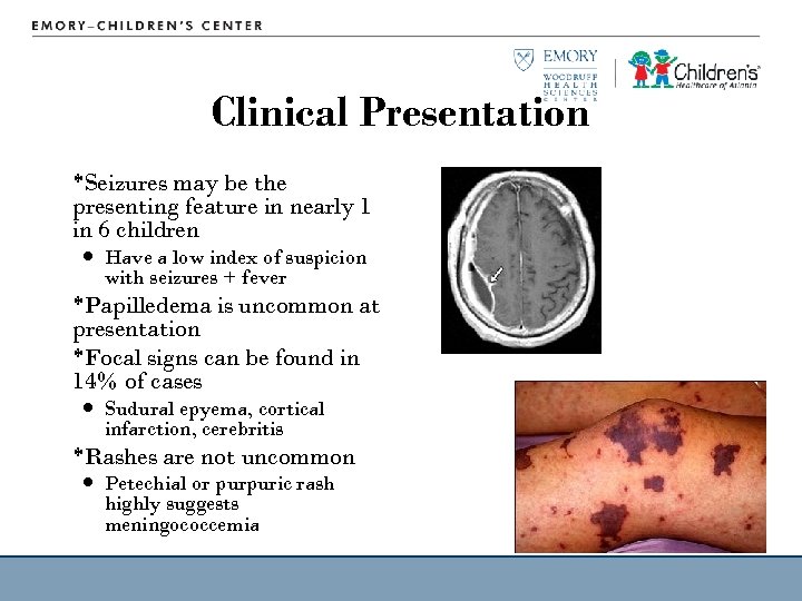 Clinical Presentation *Seizures may be the presenting feature in nearly 1 in 6 children