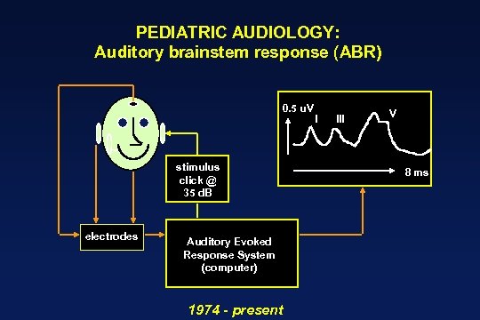 PEDIATRIC AUDIOLOGY: Auditory brainstem response (ABR) 0. 5 u. V stimulus click @ 35