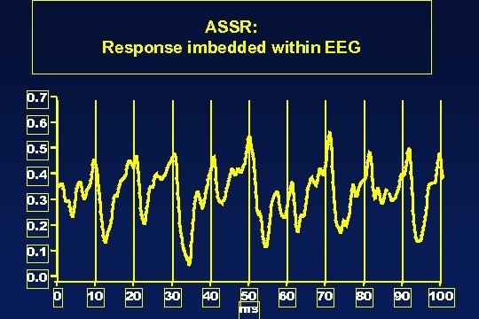 ASSR: Response imbedded within EEG 0. 7 0. 6 0. 5 0. 4 0.
