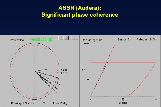 ASSR (Audera): Significant phase coherence 