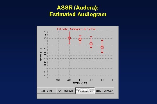 ASSR (Audera): Estimated Audiogram 