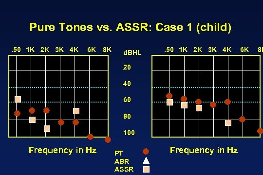 Pure Tones vs. ASSR: Case 1 (child). 50 1 K 2 K 3 K