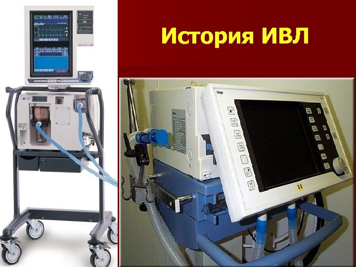 История ИВЛ 