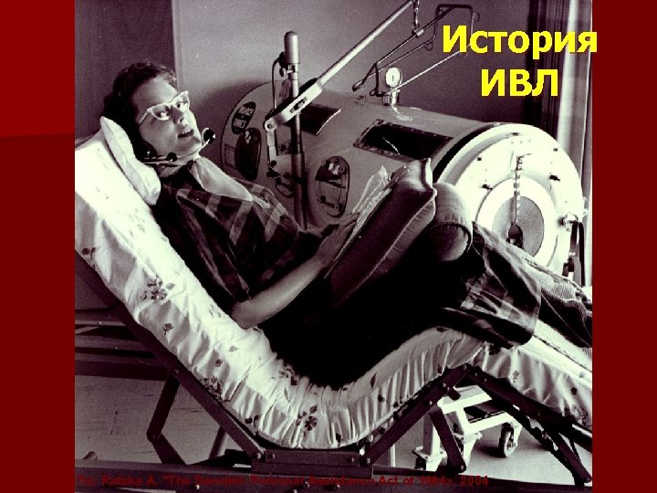 История ИВЛ По: Ratzka A. "The Swedish Personal Assistance Act of 1994» , 2004