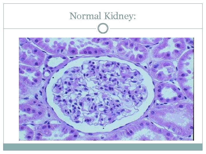 Normal Kidney: 