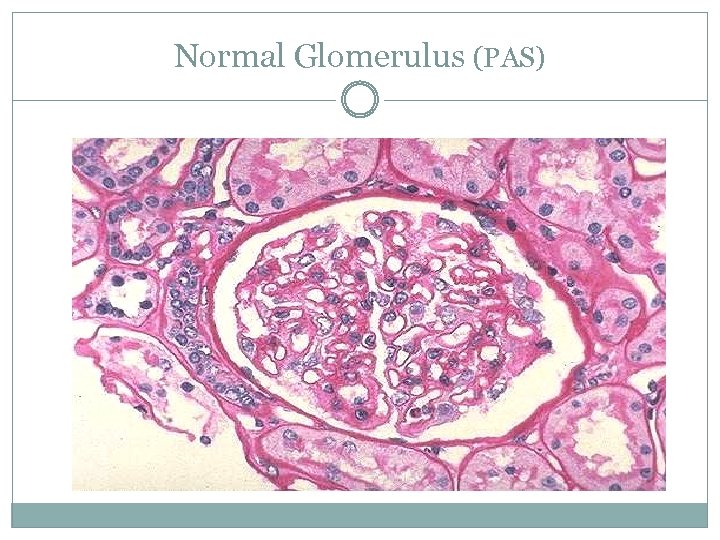 Normal Glomerulus (PAS) 