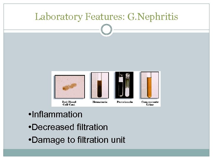 Laboratory Features: G. Nephritis • Inflammation • Decreased filtration • Damage to filtration unit