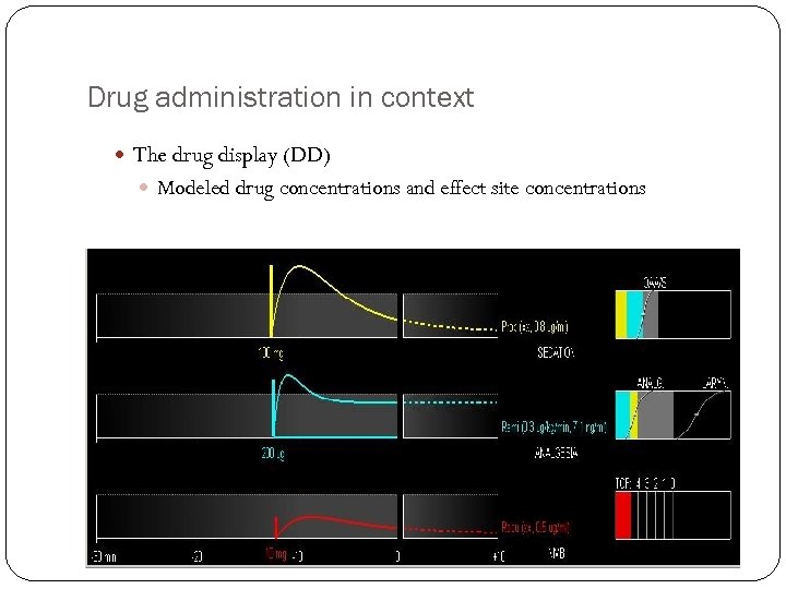 Drug administration in context The drug display (DD) Modeled drug concentrations and effect site