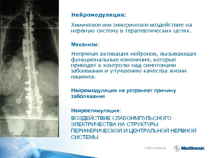 Нейромодуляция: Химическое или электрическое воздействие на нервную систему в терапевтических целях. Механизм: Непрямая активация
