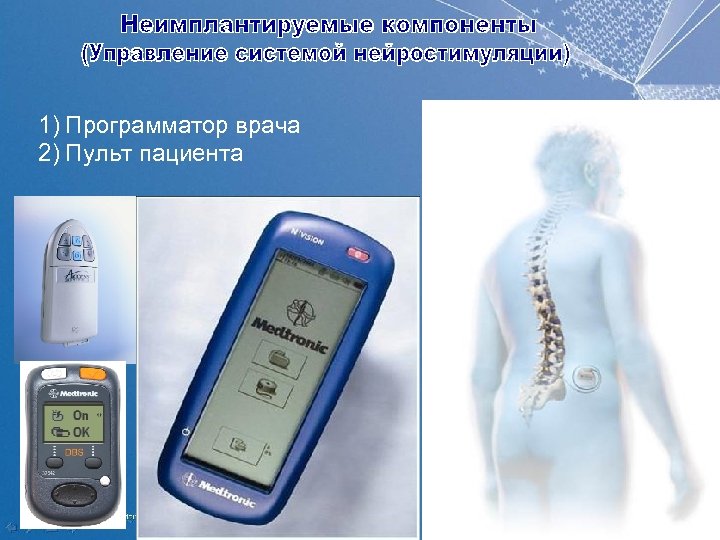 1) Программатор врача 2) Пульт пациента 6 | MDT Confidential 