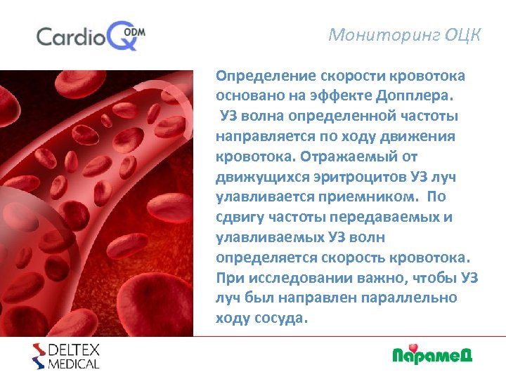 Мониторинг ОЦК Определение скорости кровотока основано на эффекте Допплера. УЗ волна определенной частоты направляется