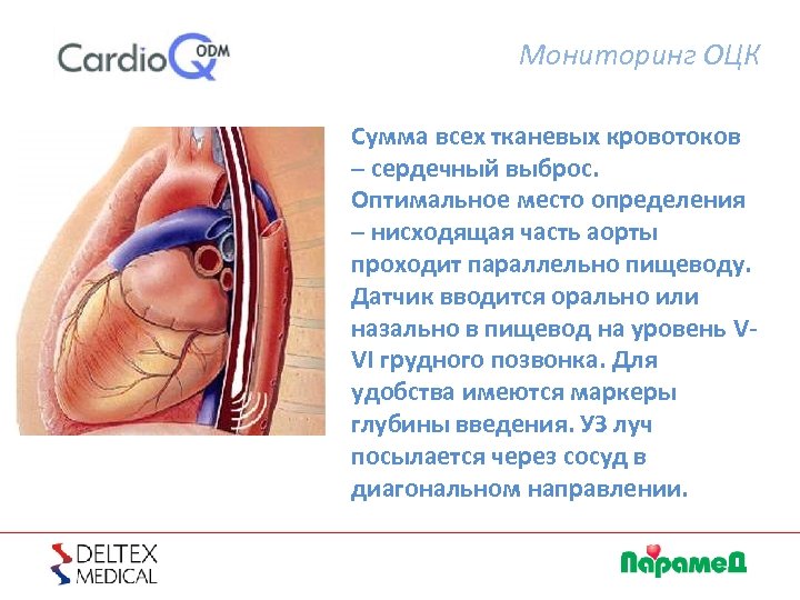 Мониторинг ОЦК Сумма всех тканевых кровотоков – сердечный выброс. Оптимальное место определения – нисходящая